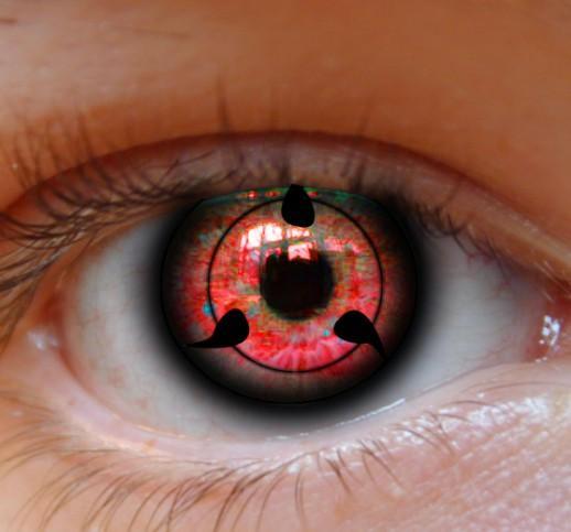 Contact lens