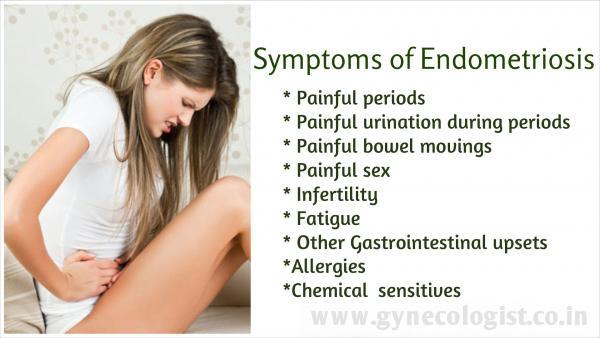 Surviving Endometriosis